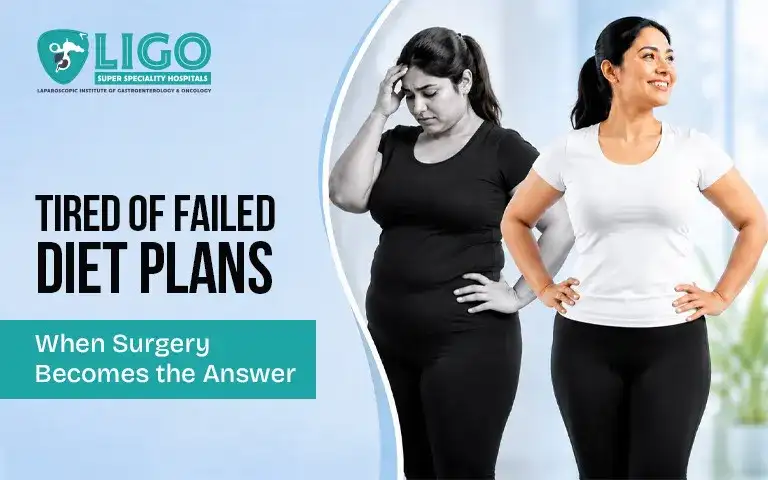 From diet failures to surgical success when weight loss surgery is recommended
